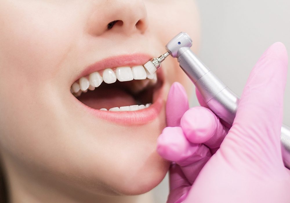 dentist-brushes-teeth-young-girl-teeth-whitening-2022-11-15-05-20-50-utc